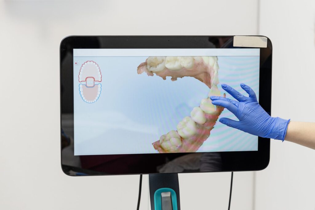 Orthodontist reviewing a live 3D digital scan of the teeth – Invisalign for complex cases
